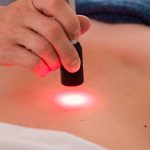 Laser Terapia