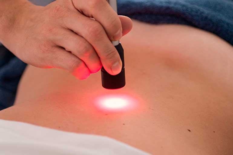 Laser Terapia